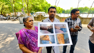 SURAT : સુરતમાં પતિ-પત્ની વિવાદે લીધો ગંભીર વળાંક